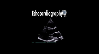 10 Ways to Assess Severity of AR with Echocardiography
